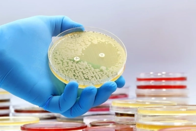 Residual Solvents Analysis