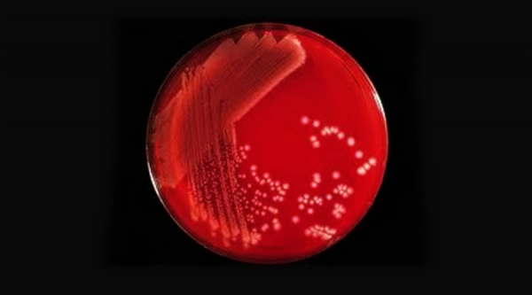 Residual Solvents Analysis